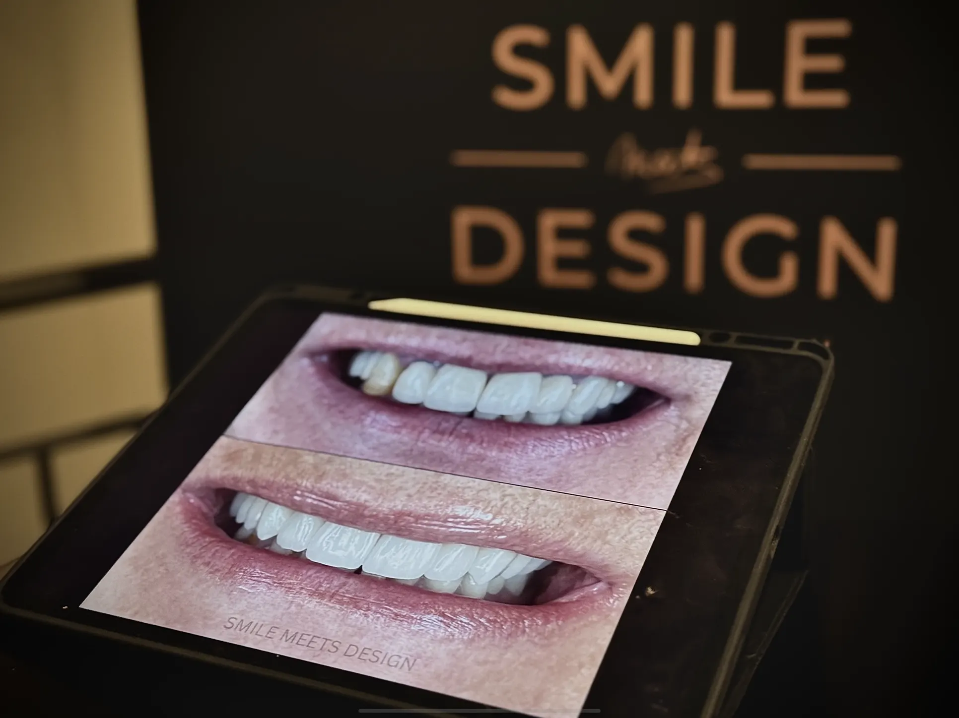 Smile Designer Lounge